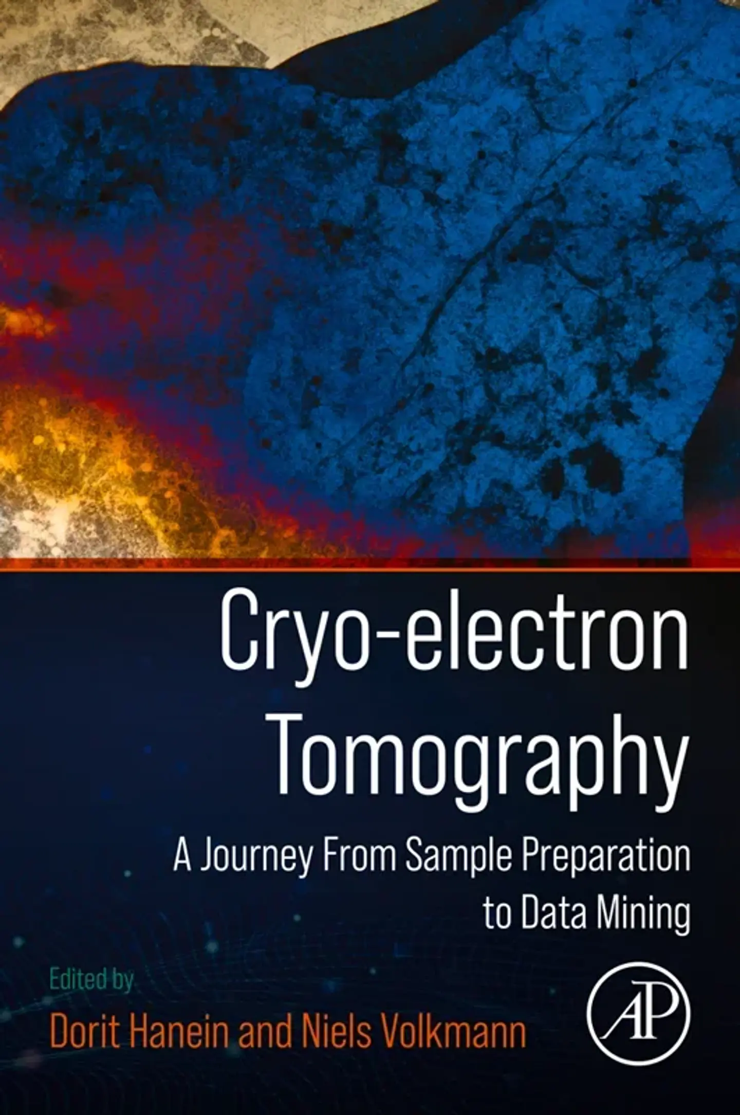 Cryo-electron Tomography: A Journey from Sample Preparation to Data Mining 1