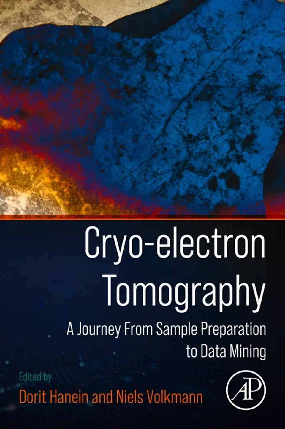 Cryo-electron Tomography: A Journey from Sample Preparation to Data Mining 1
