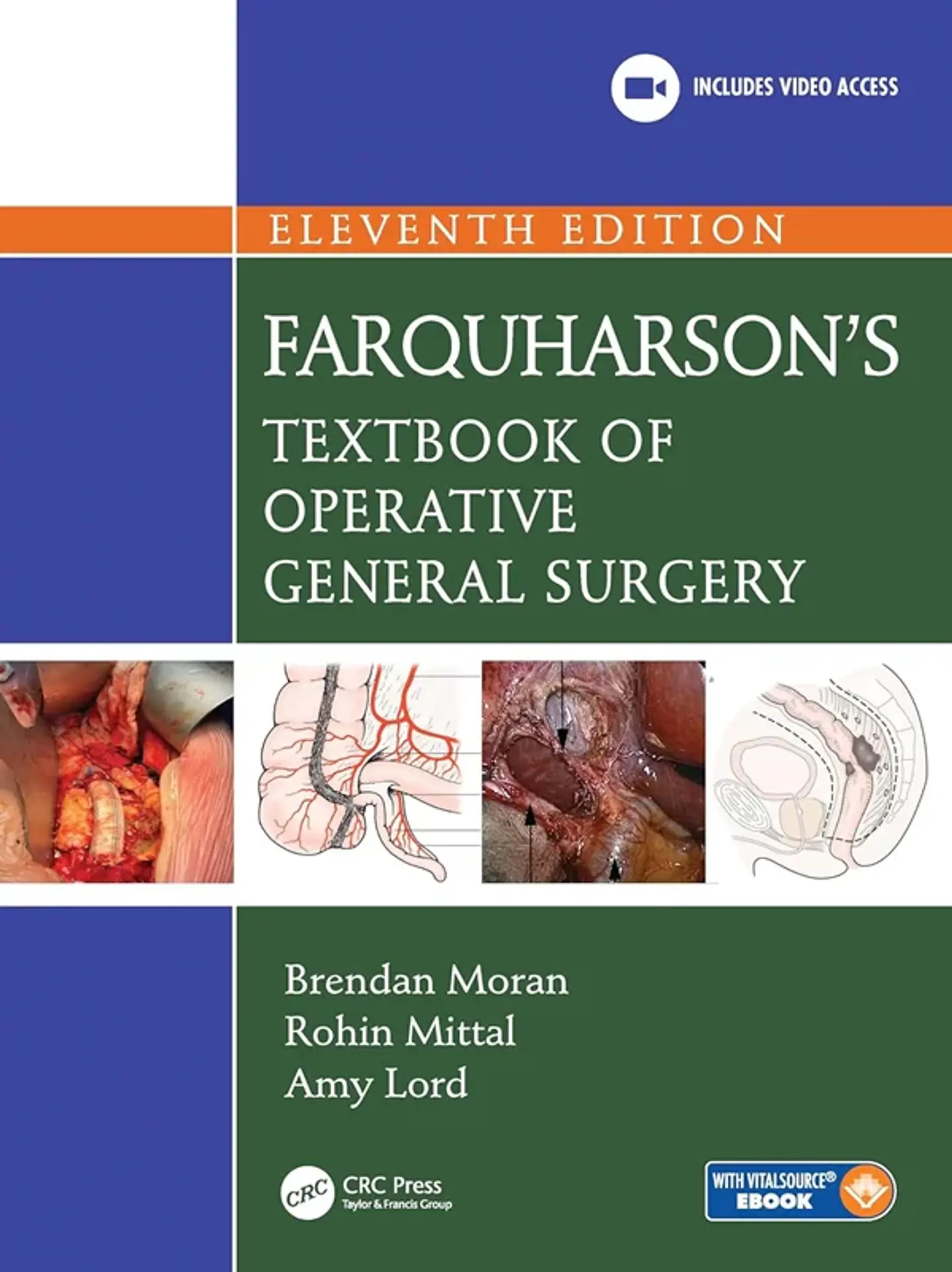 Farquharson's Textbook of Operative General Surgery 11th Edition 1