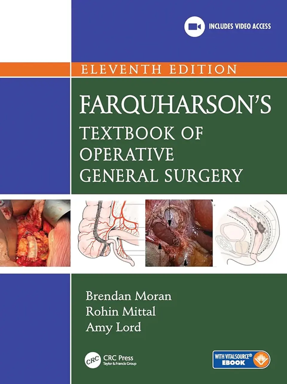 Farquharson's Textbook of Operative General Surgery 11th Edition 1
