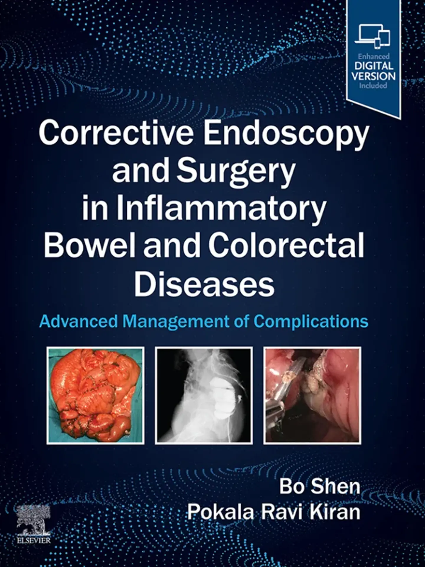 Corrective Endoscopy and Surgery in Inflammatory Bowel and Colorectal Diseases: Advanced Management of Complications 1
