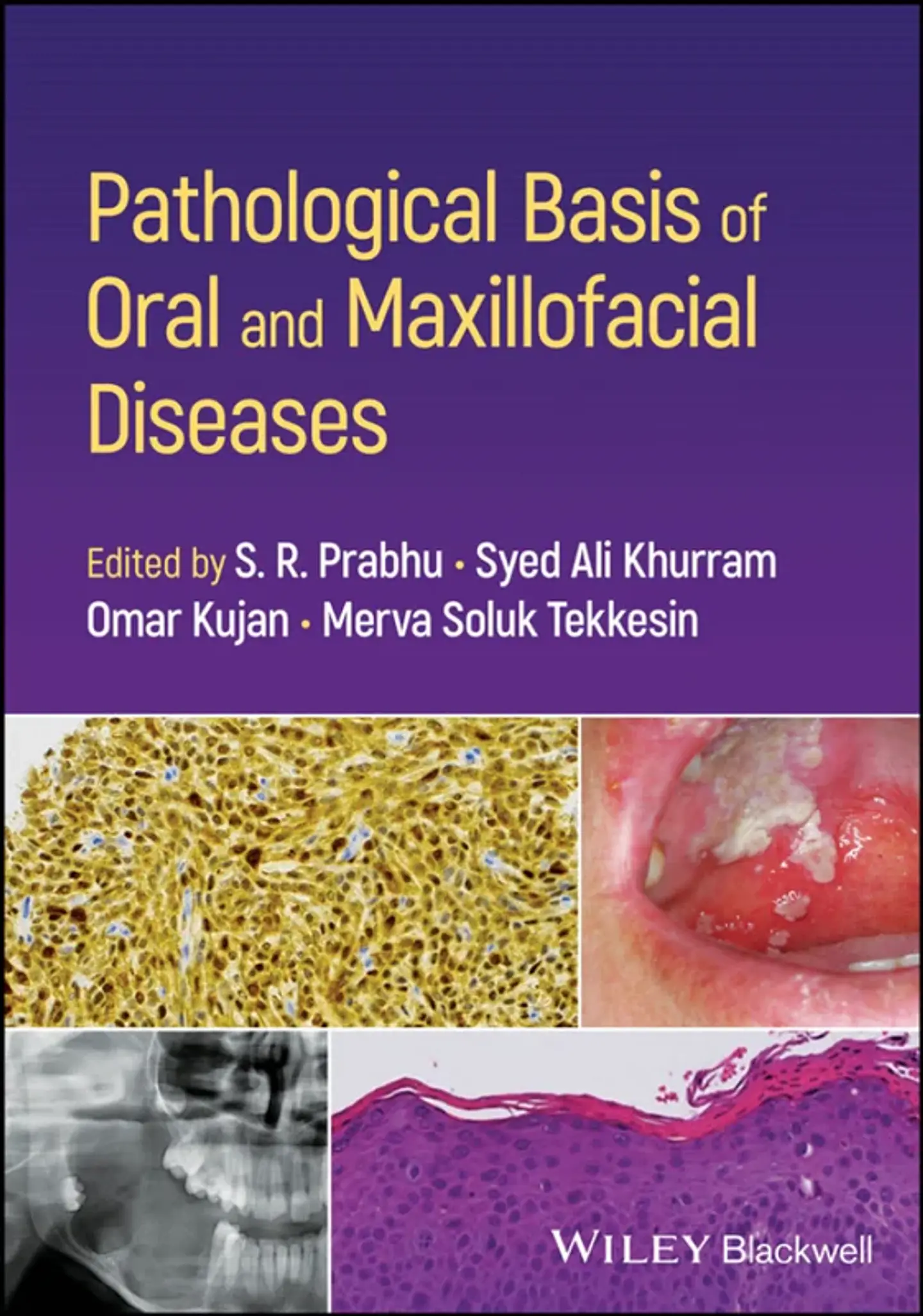 Pathological Basis of Oral and Maxillofacial Diseases 1