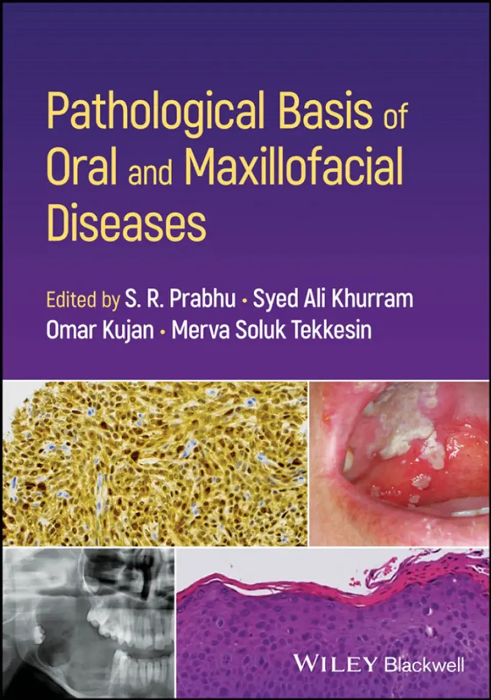 Pathological Basis of Oral and Maxillofacial Diseases 1
