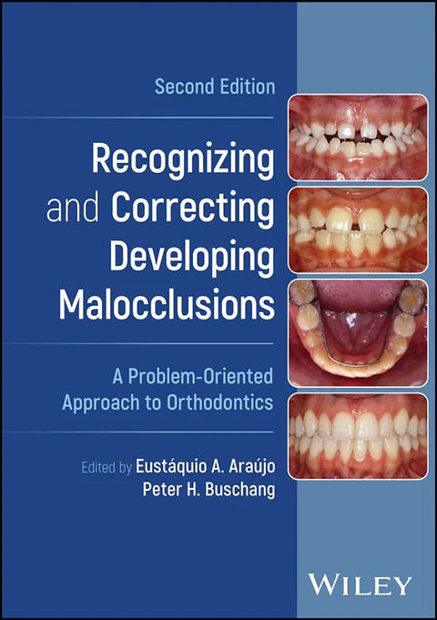 Recognizing and Correcting Developing Malocclusions: A Problem-Oriented Approach to Orthodontics 2nd Edition