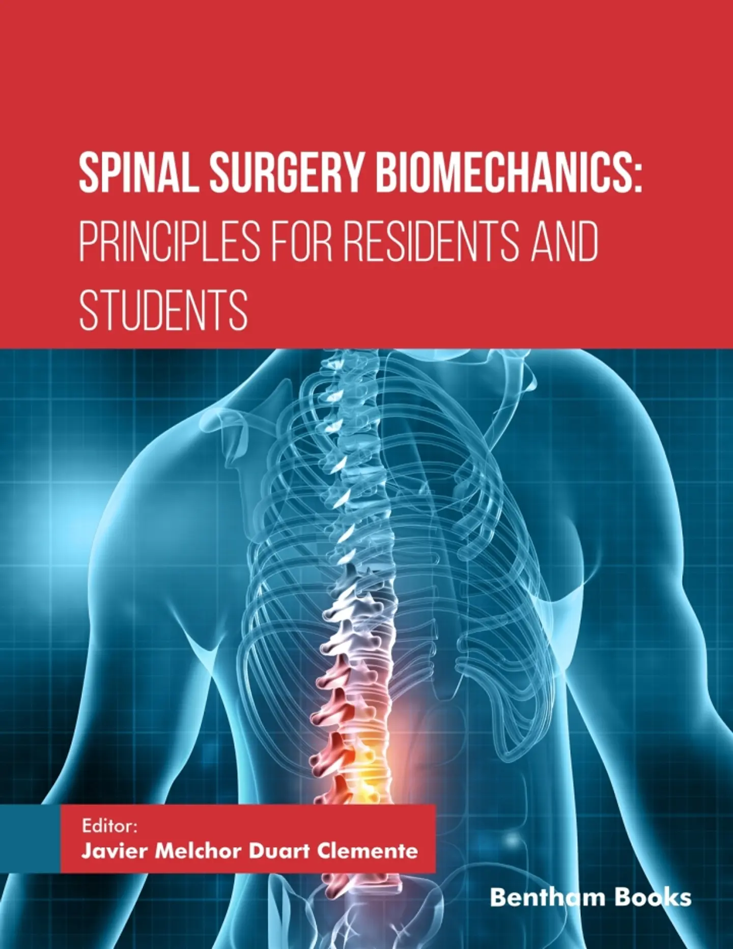 Spinal Surgery Biomechanics: Principles for Residents and Students 1