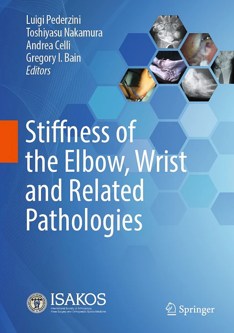 Stiffness of the Elbow, Wrist and Related Pathologies 