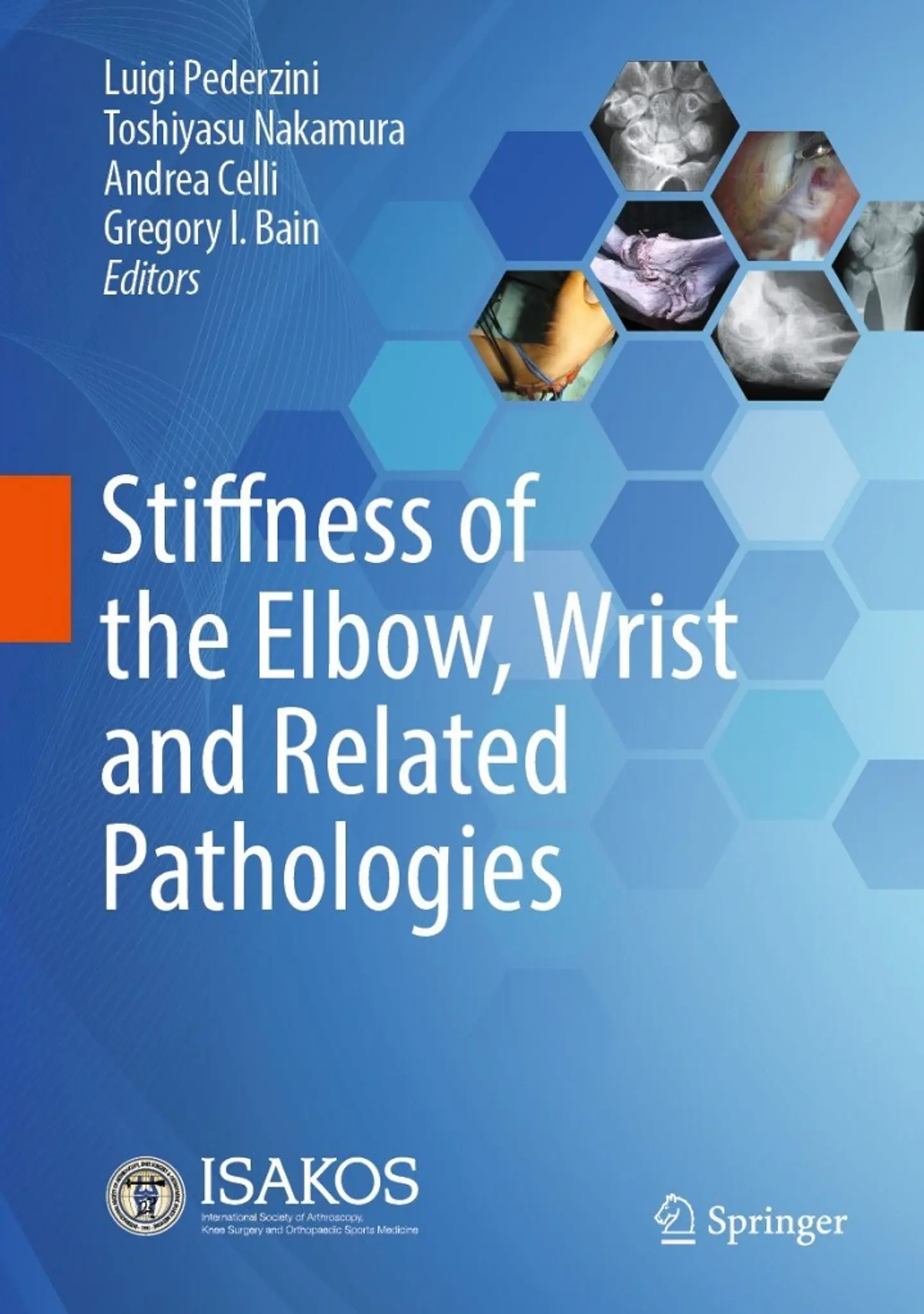 Stiffness of the Elbow, Wrist and Related Pathologies  1