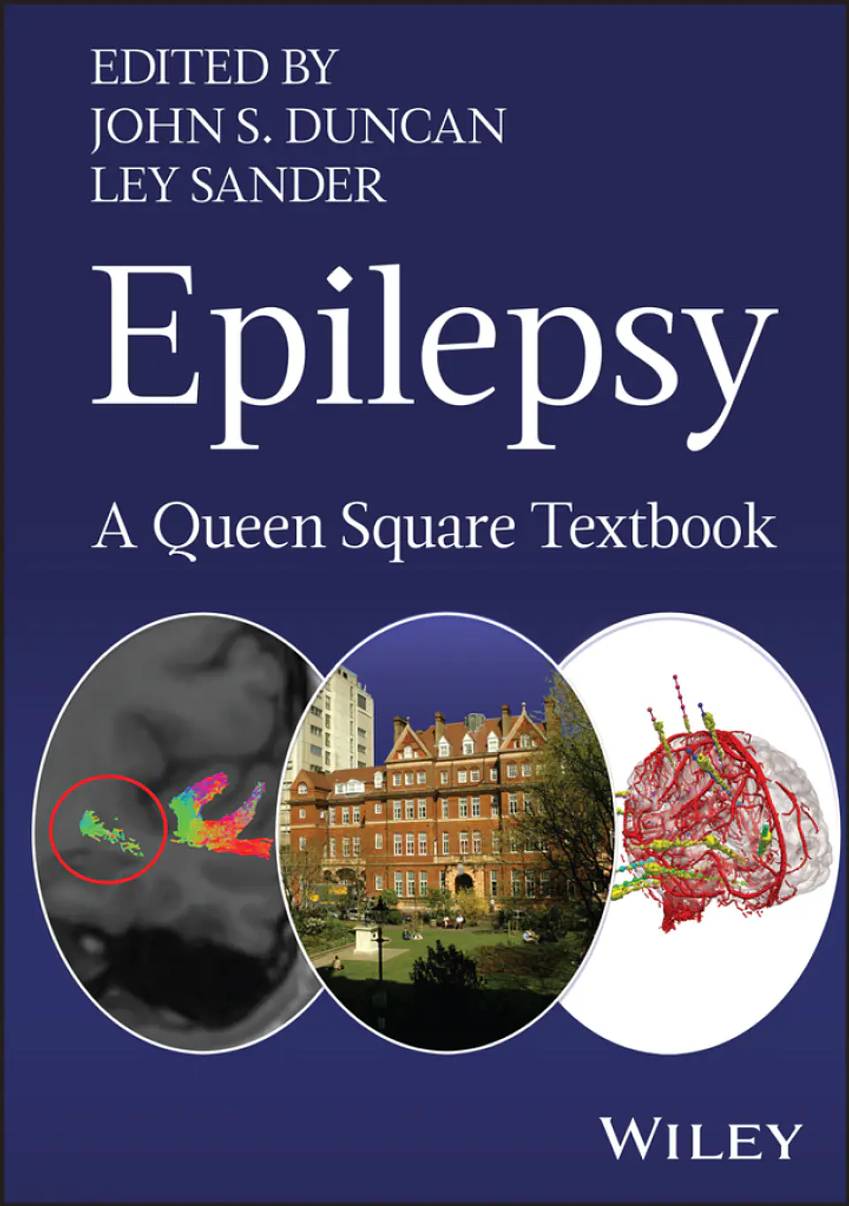 Epilepsy: A Queen Square Textbook 1