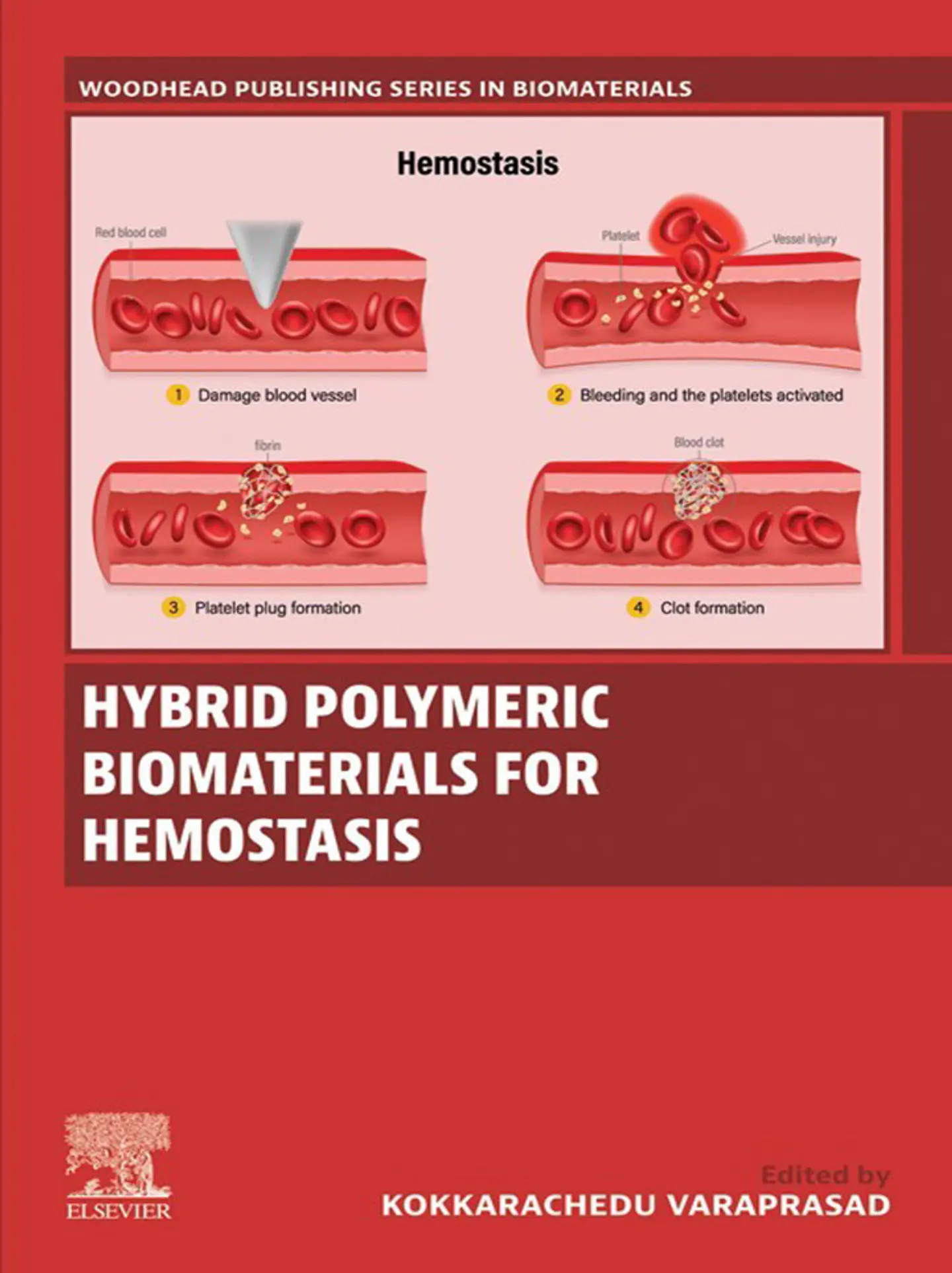 Hybrid Polymeric Biomaterials for Hemostasis 1