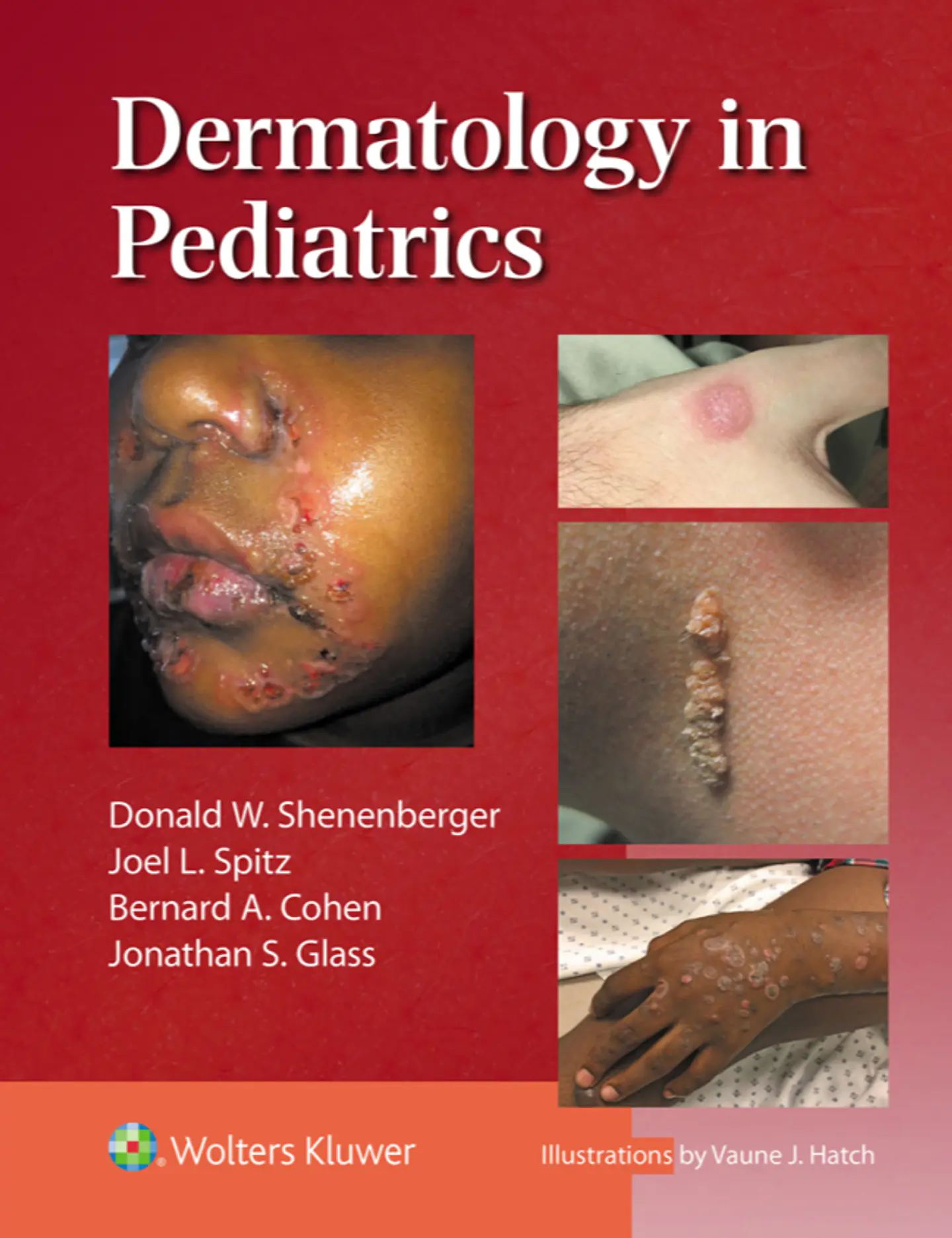 Dermatology in Pediatrics  1
