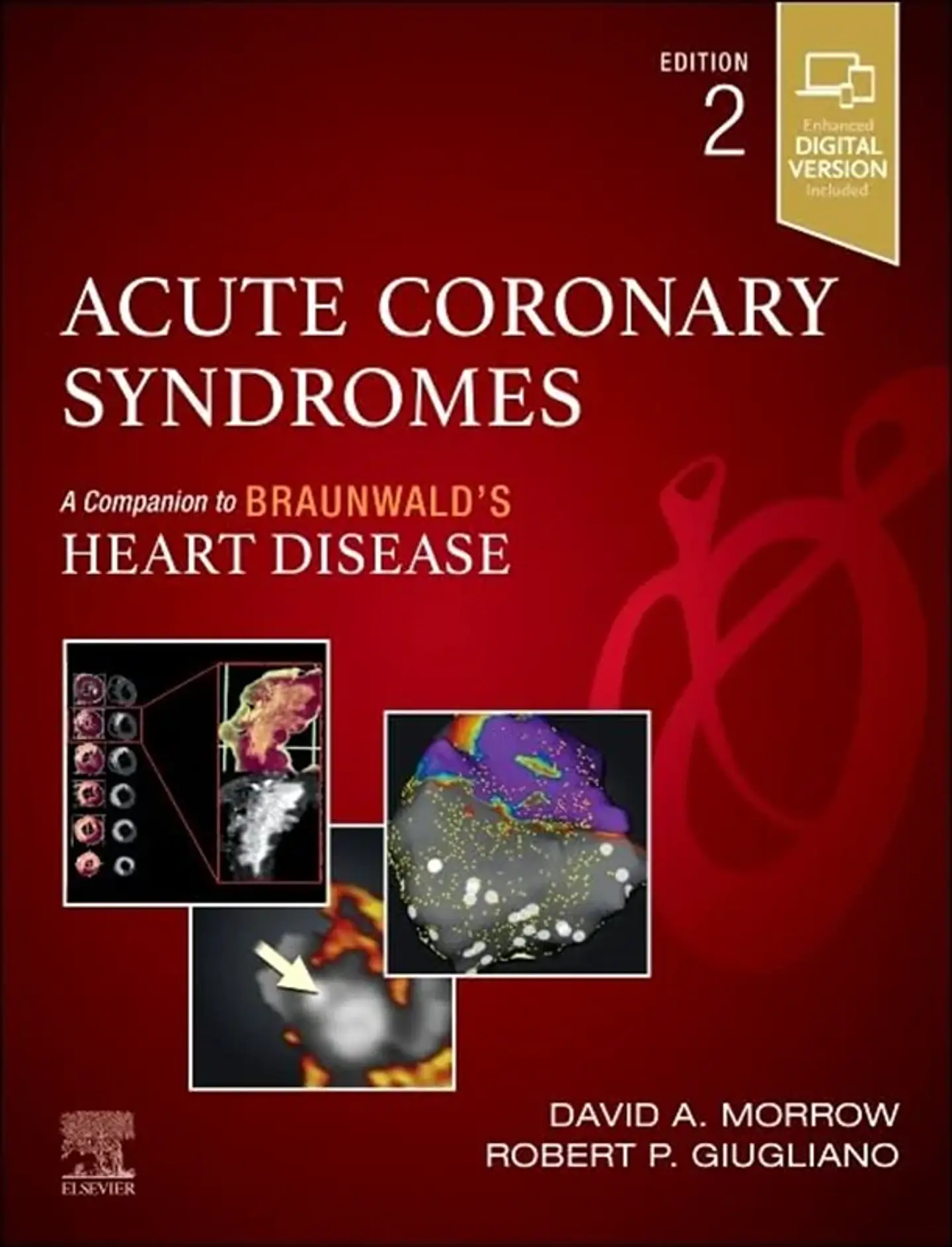 Acute Coronary Syndromes: A Companion to Braunwald's Heart Disease 2nd Edition 1
