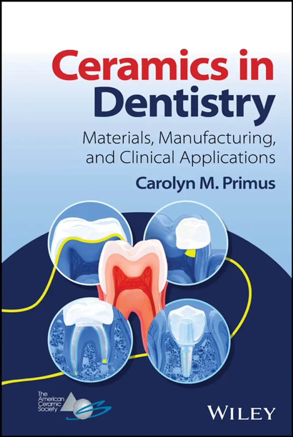 Ceramics in Dentistry: Materials, Manufacturing, and Clinical Applications 1