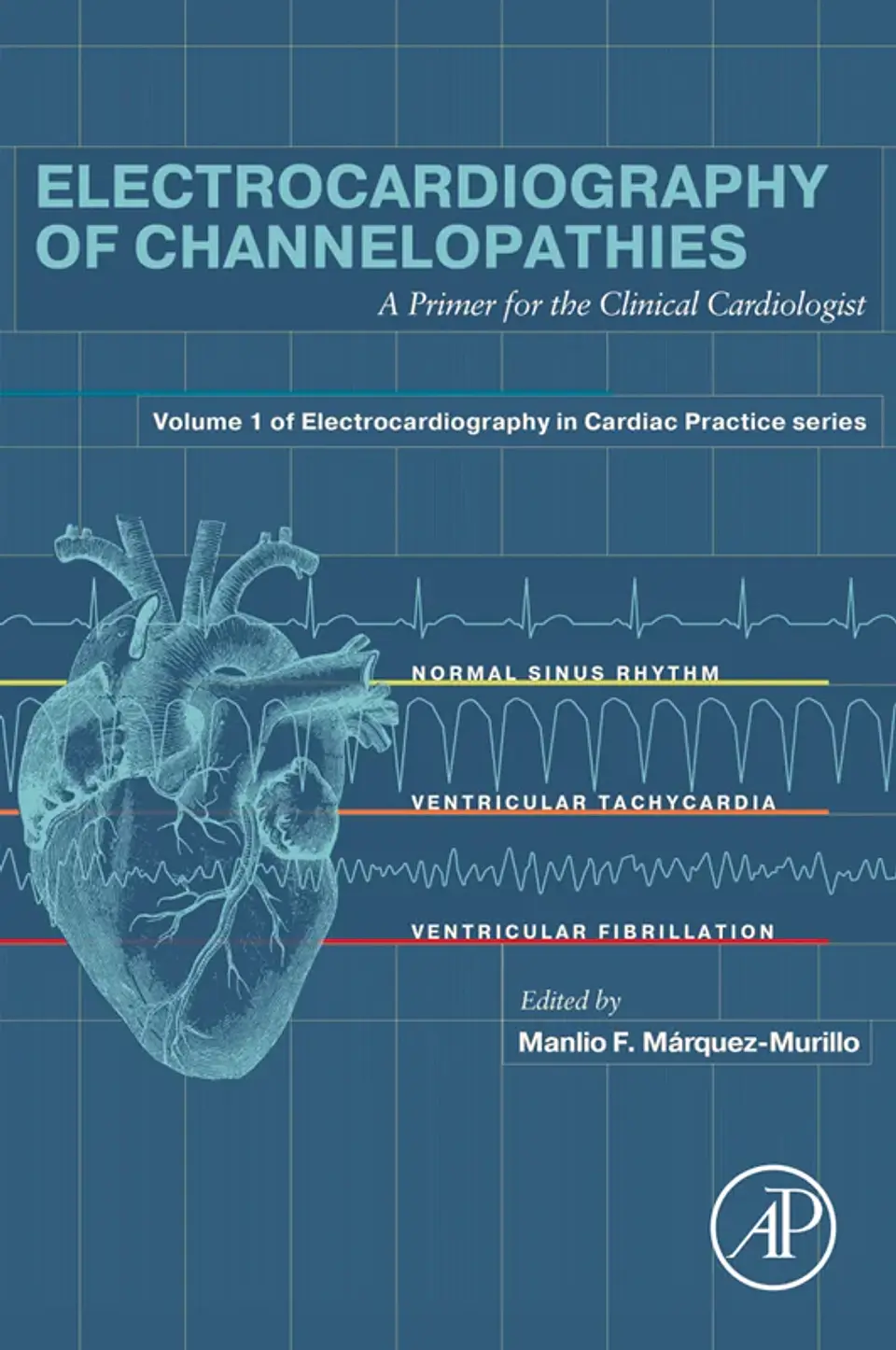 Electrocardiography of Channelopathies: A Primer for the Clinical Cardiologist 1