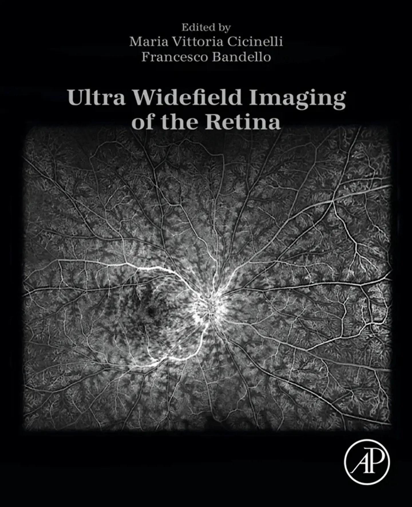 Ultra Widefield Imaging of the Retina 1