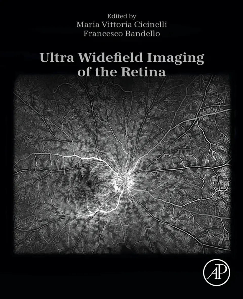 Ultra Widefield Imaging of the Retina 1