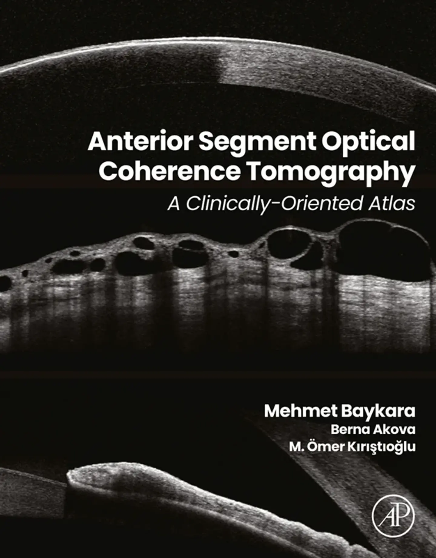 Anterior Segment Optical Coherence Tomography: A Clinically-Oriented Atlas 1
