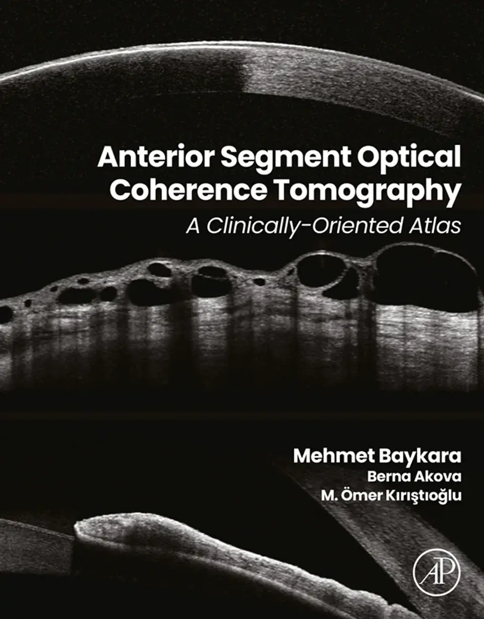 Anterior Segment Optical Coherence Tomography: A Clinically-Oriented Atlas 1