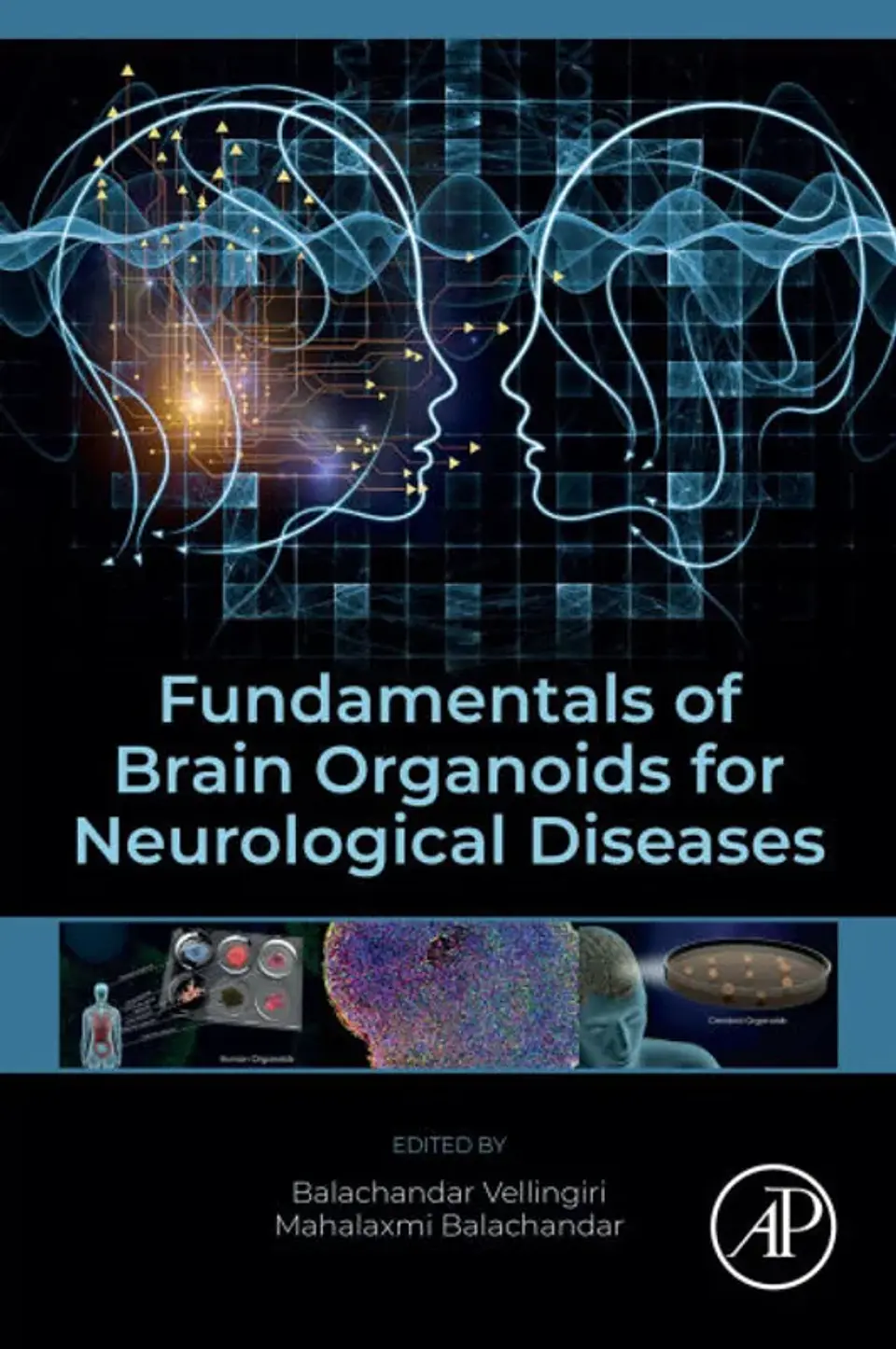 Fundamentals of Brain Organoids for Neurological Diseases 1
