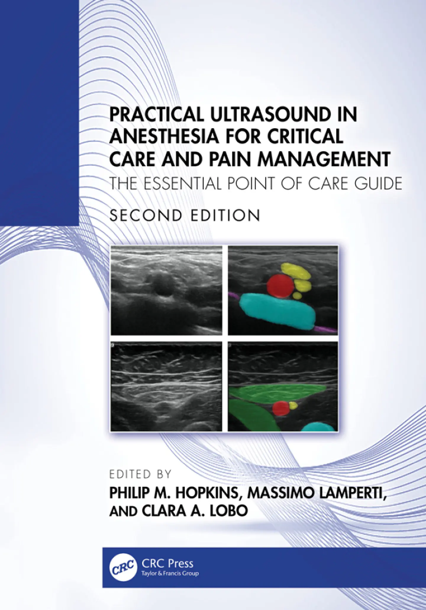 Practical Ultrasound in Anesthesia for Critical Care and Pain Management: The Essential Point of Care Guide 2nd Edition  1