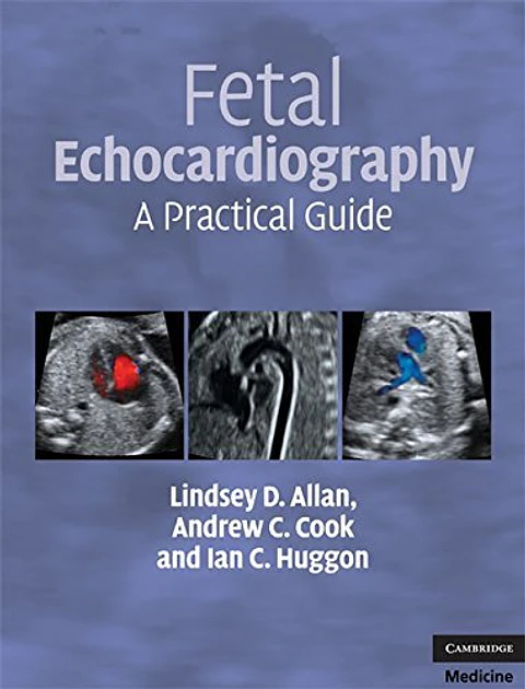  Fetal Echocardiography: A Practical Guide (Allan, Fetal Echocardiography) 