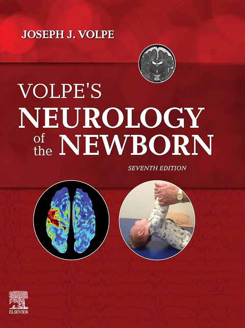  Volpe's Neurology of the Newborn 7th Edition 