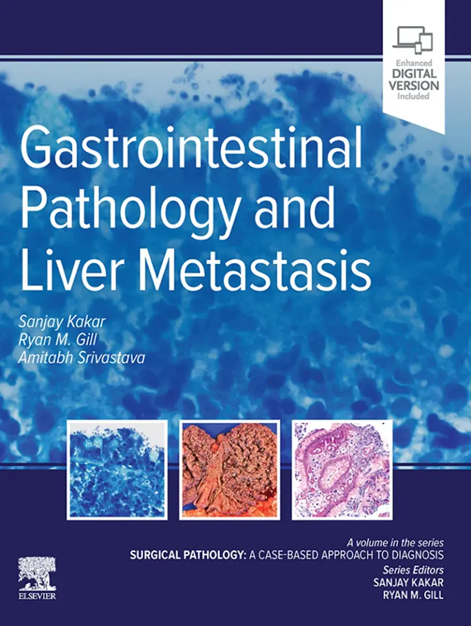 Gastrointestinal Pathology and Liver Metastasis: A Case-Based Approach to Diagnosis 1