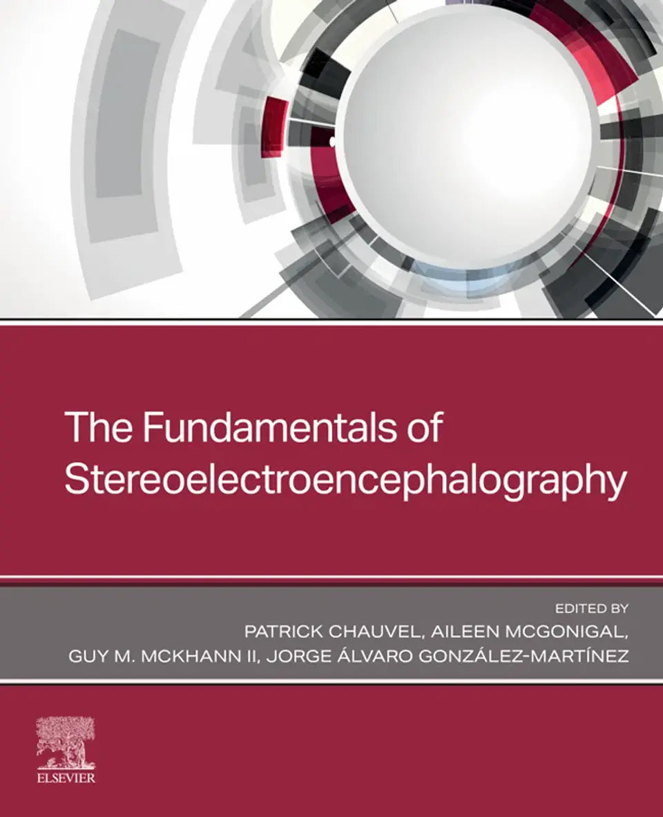 The Fundamentals of Stereoelectroencephalography 1