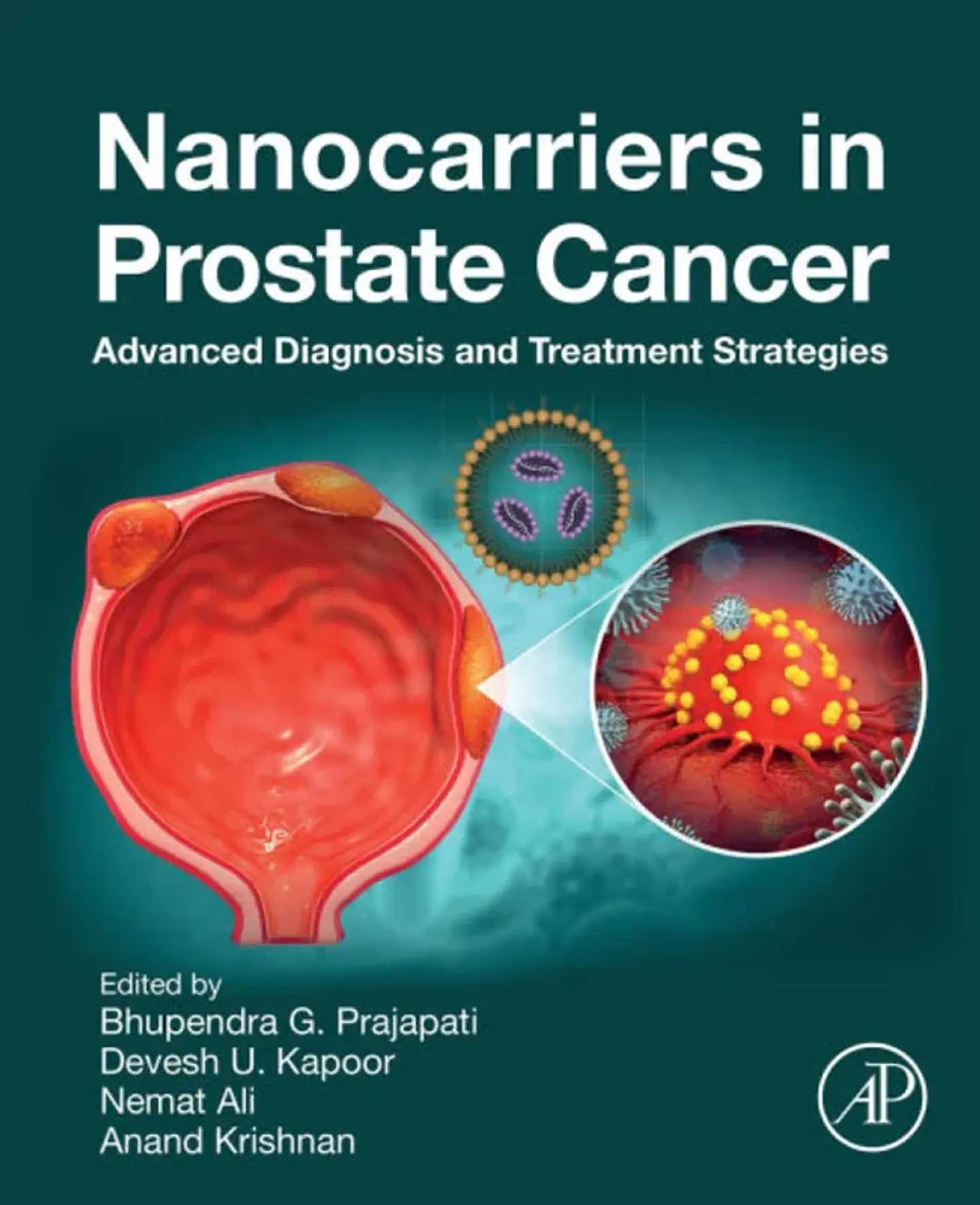 Nanocarriers in Prostate Cancer: Advanced Diagnosis and Treatment Strategie 1