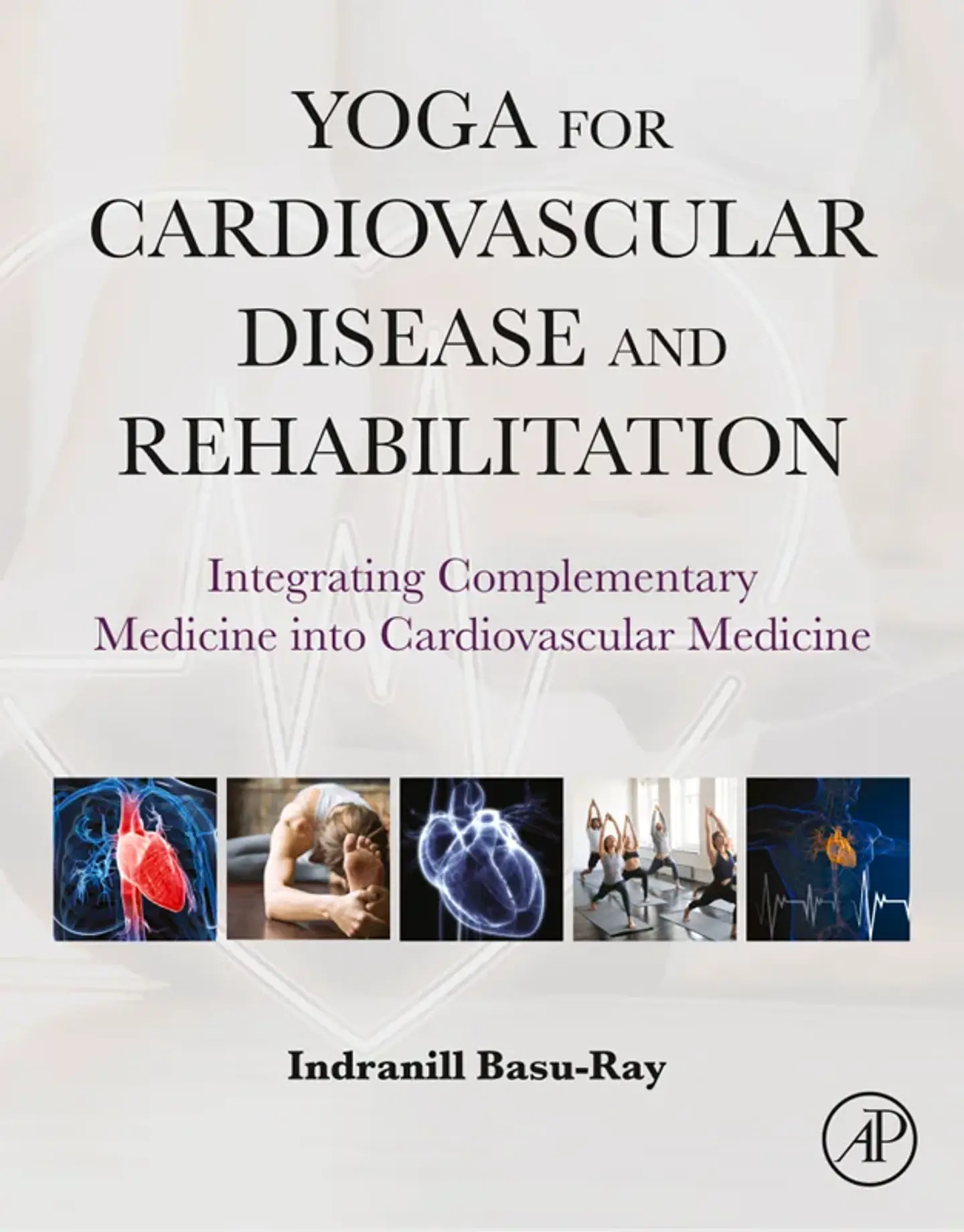Yoga for Cardiovascular Disease and Rehabilitation: Integrating Complementary Medicine into Cardiovascular Medicine 1