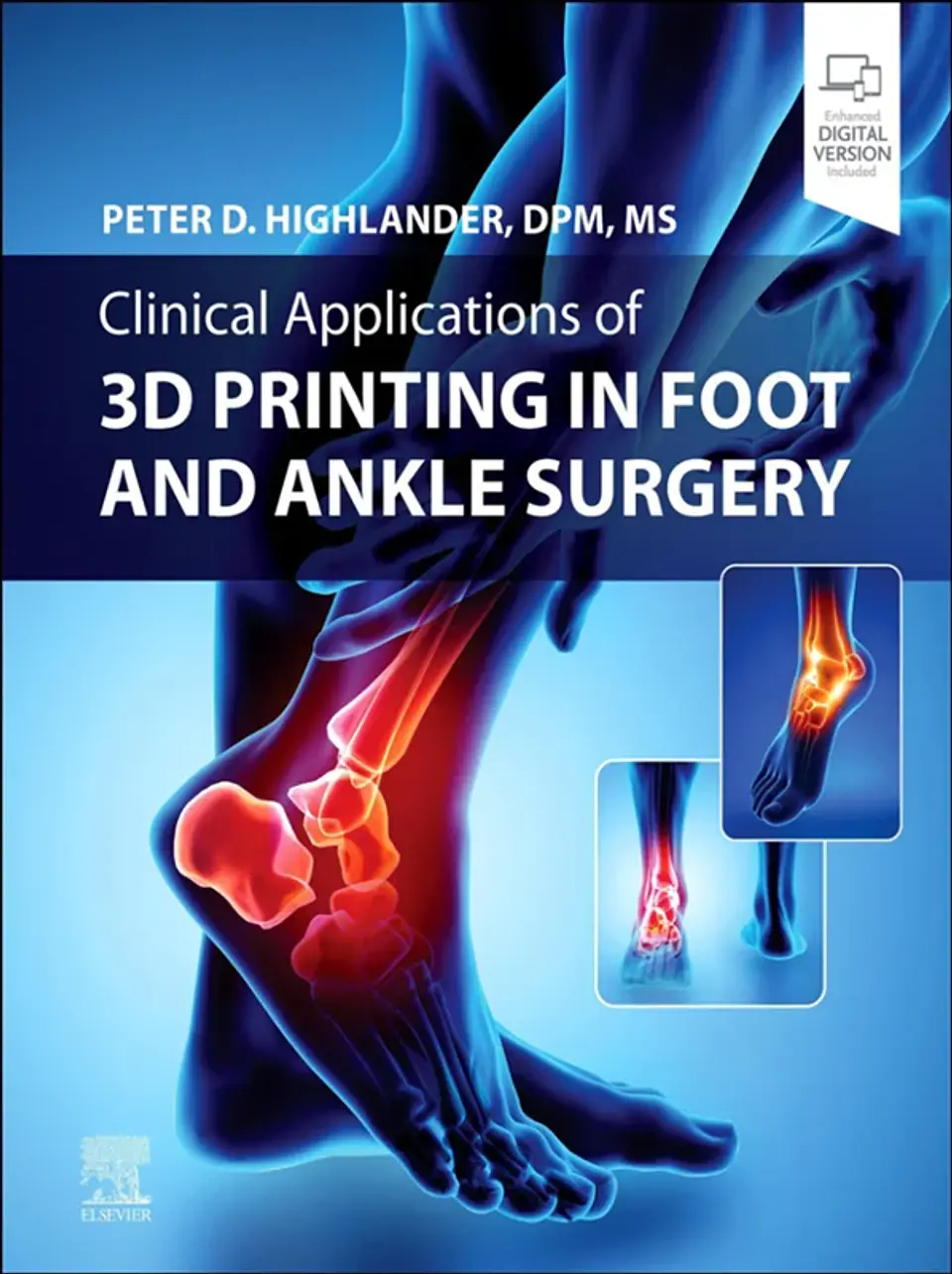 Clinical Application of 3D Printing in Foot & Ankle Surgery 1
