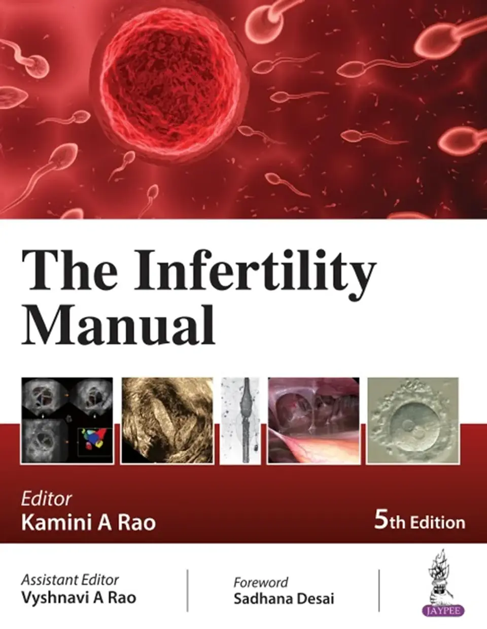 The Infertility Manual 5th Edition 1