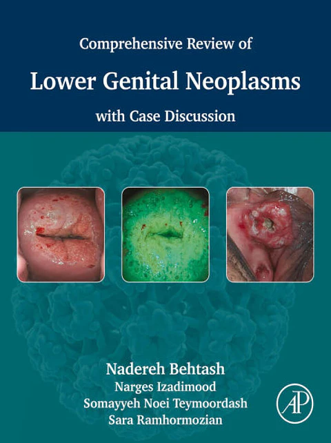 Comprehensive review of lower genital neoplasms: With case discussion