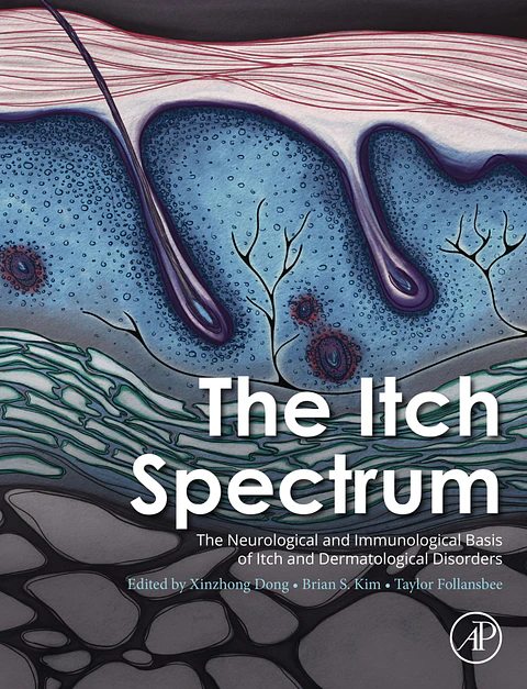 The Itch Spectrum