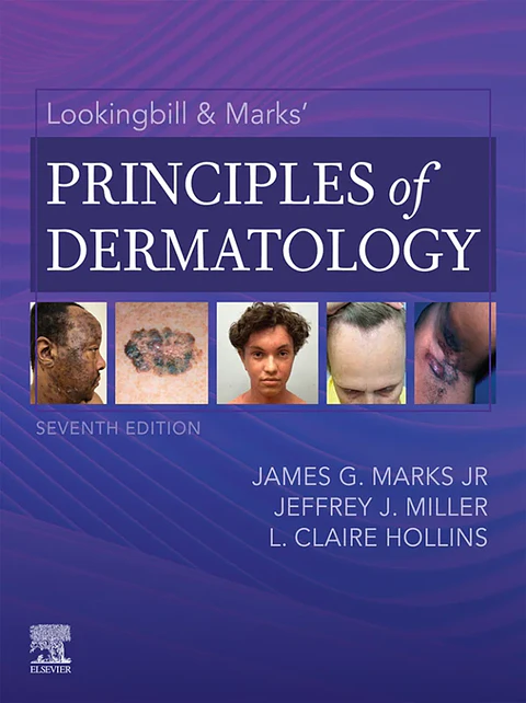 Lookingbill & Marks’ Principles of Dermatology 7th Edition