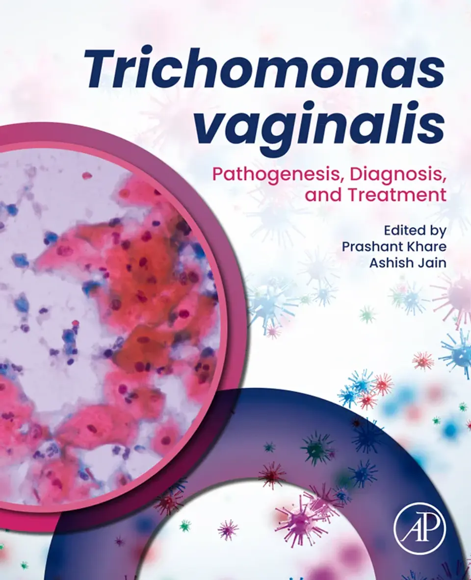 Trichomonas vaginalis: Pathogenesis, Diagnosis, and Treatment 1