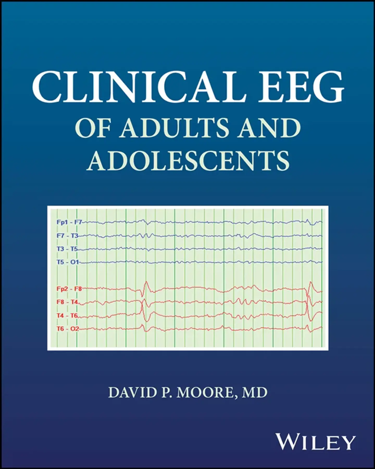 Clinical EEG of Adults and Adolescents 1