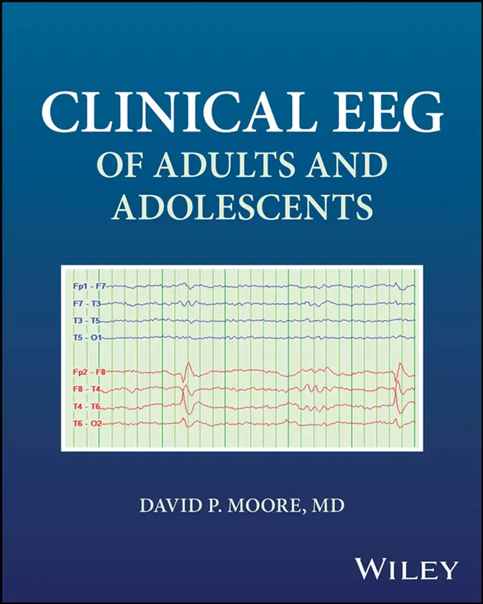 Clinical EEG of Adults and Adolescents 1
