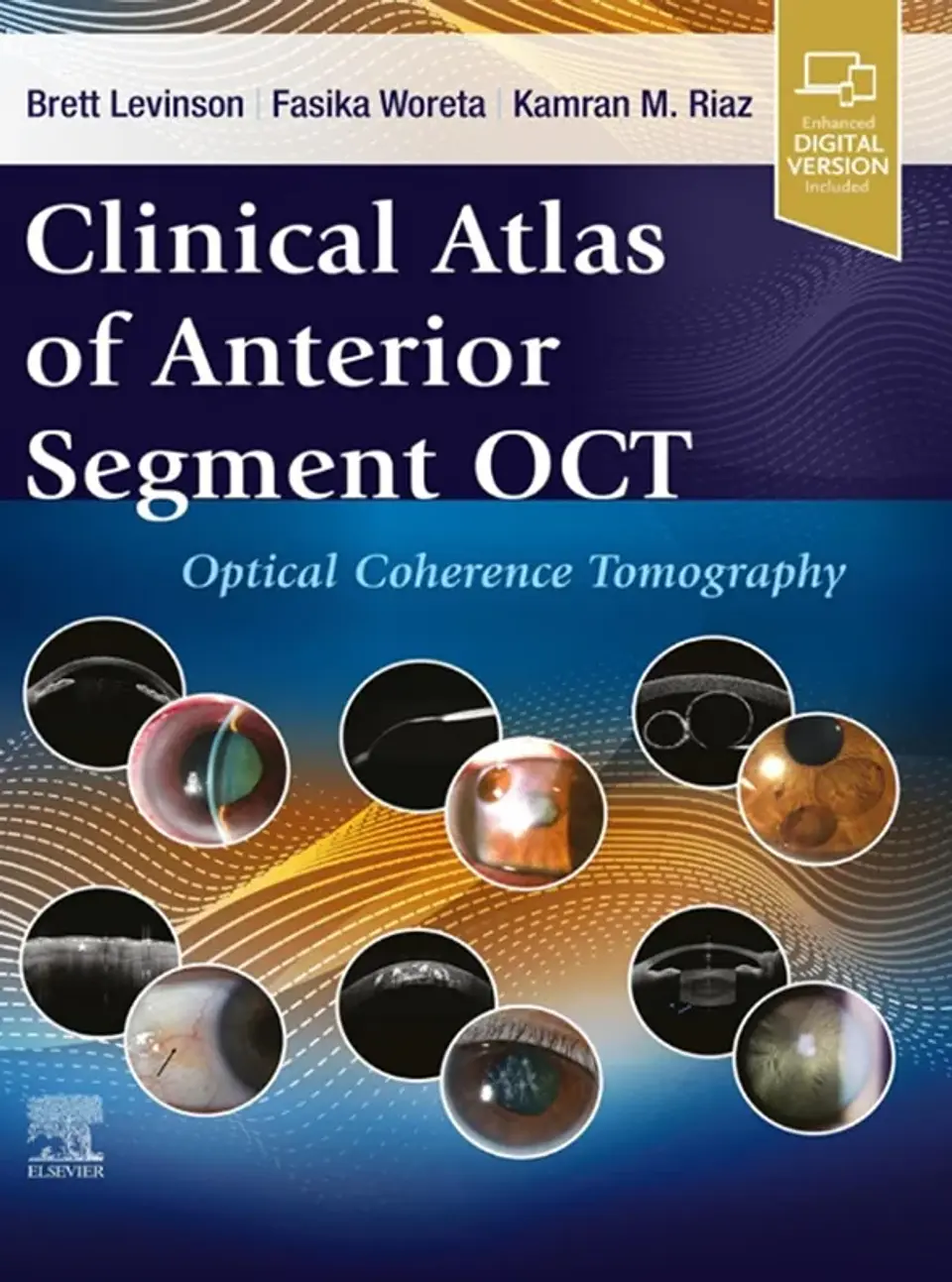 Clinical Atlas of Anterior Segment OCT: Optical Coherence Tomography 1