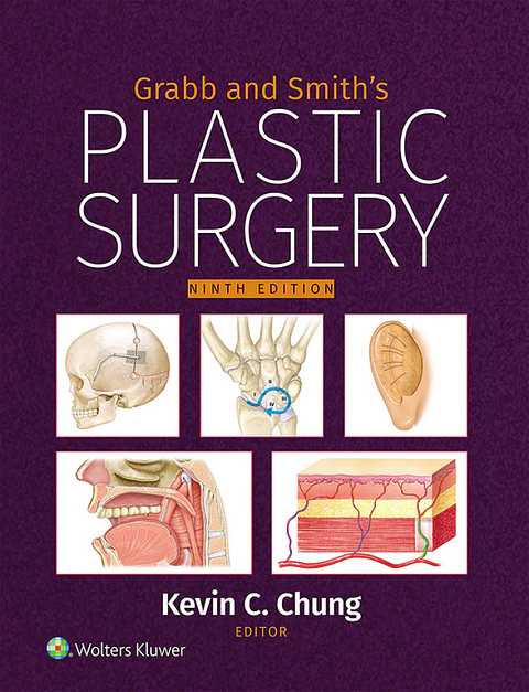  Grabb and Smith's Plastic Surgery 9th Edition 