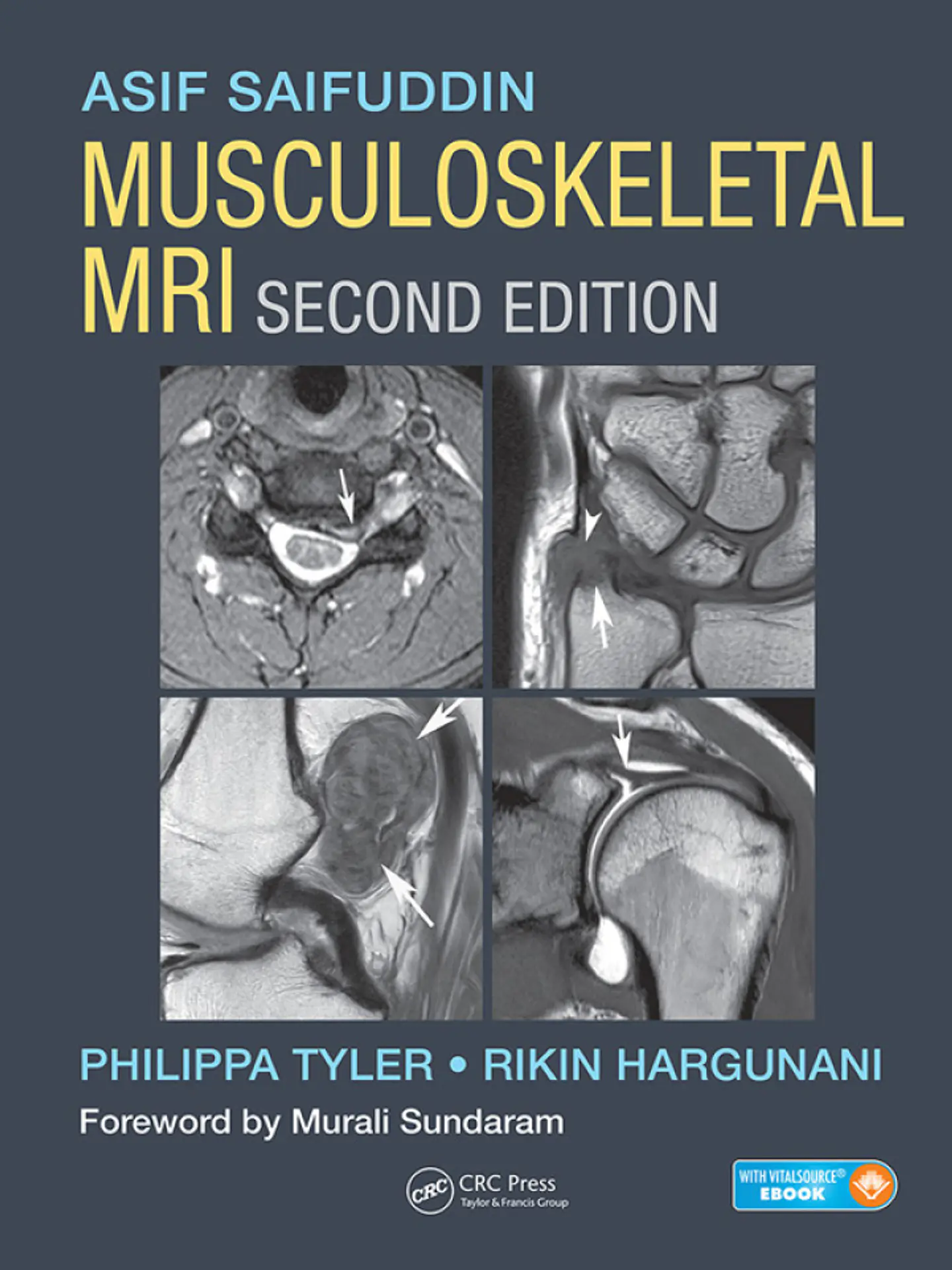 Musculoskeletal MRI 2nd Edition 1