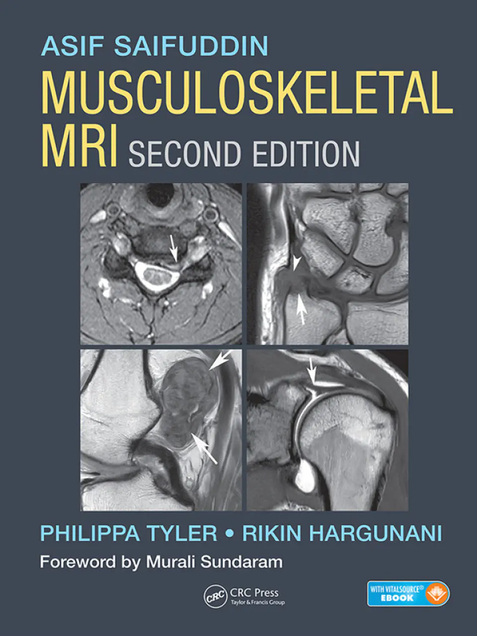 Musculoskeletal MRI 2nd Edition 1