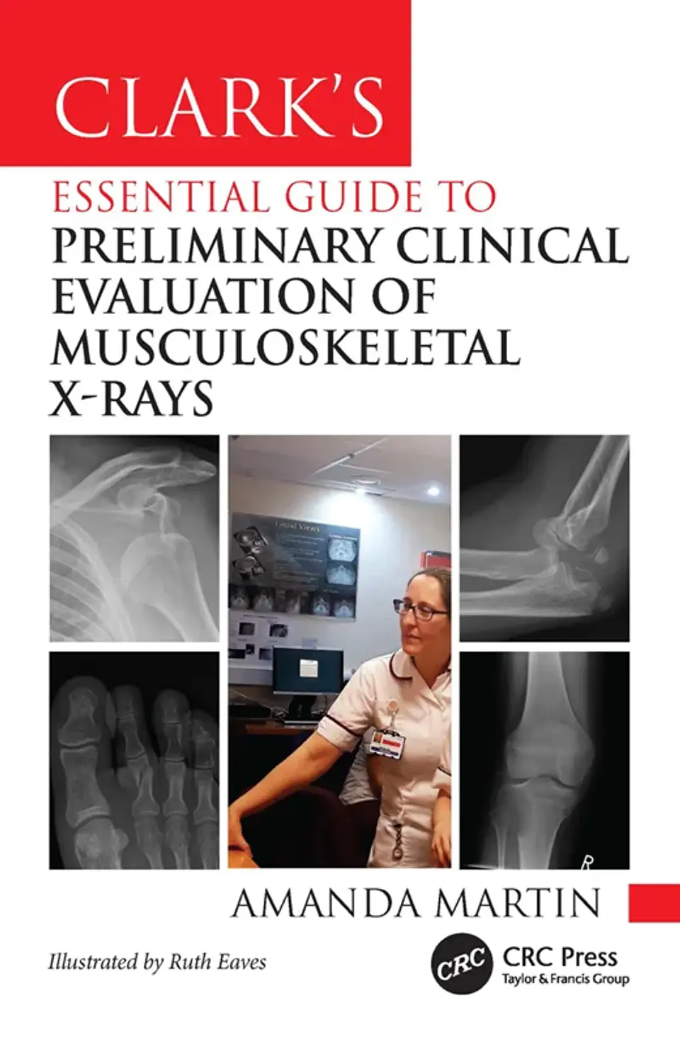  Clark’s Essential Guide to Preliminary Clinical Evaluation of Musculoskeletal X-rays: Evaluating and Commenting on Images  1