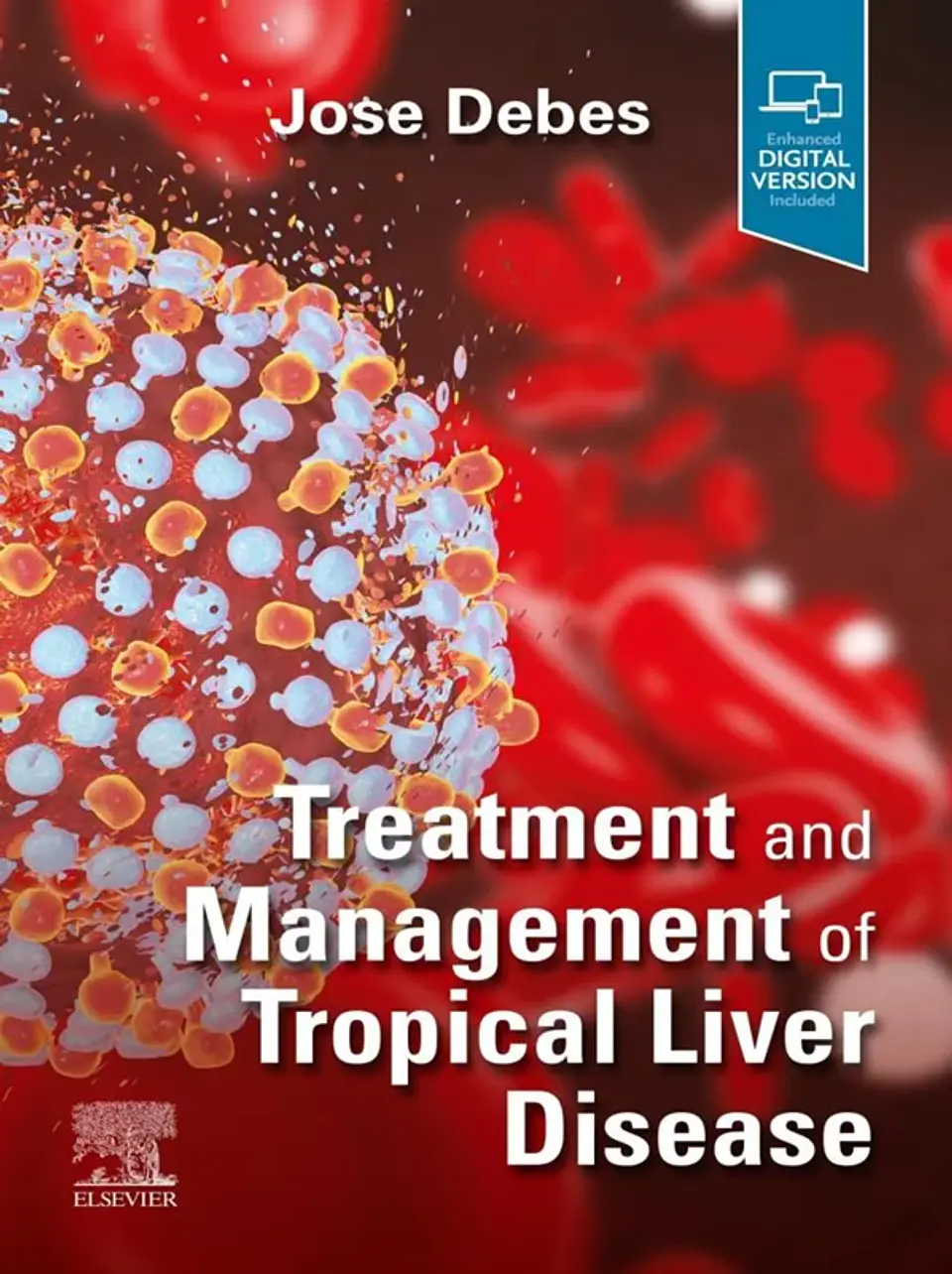 Treatment and Management of Tropical Liver Disease 1