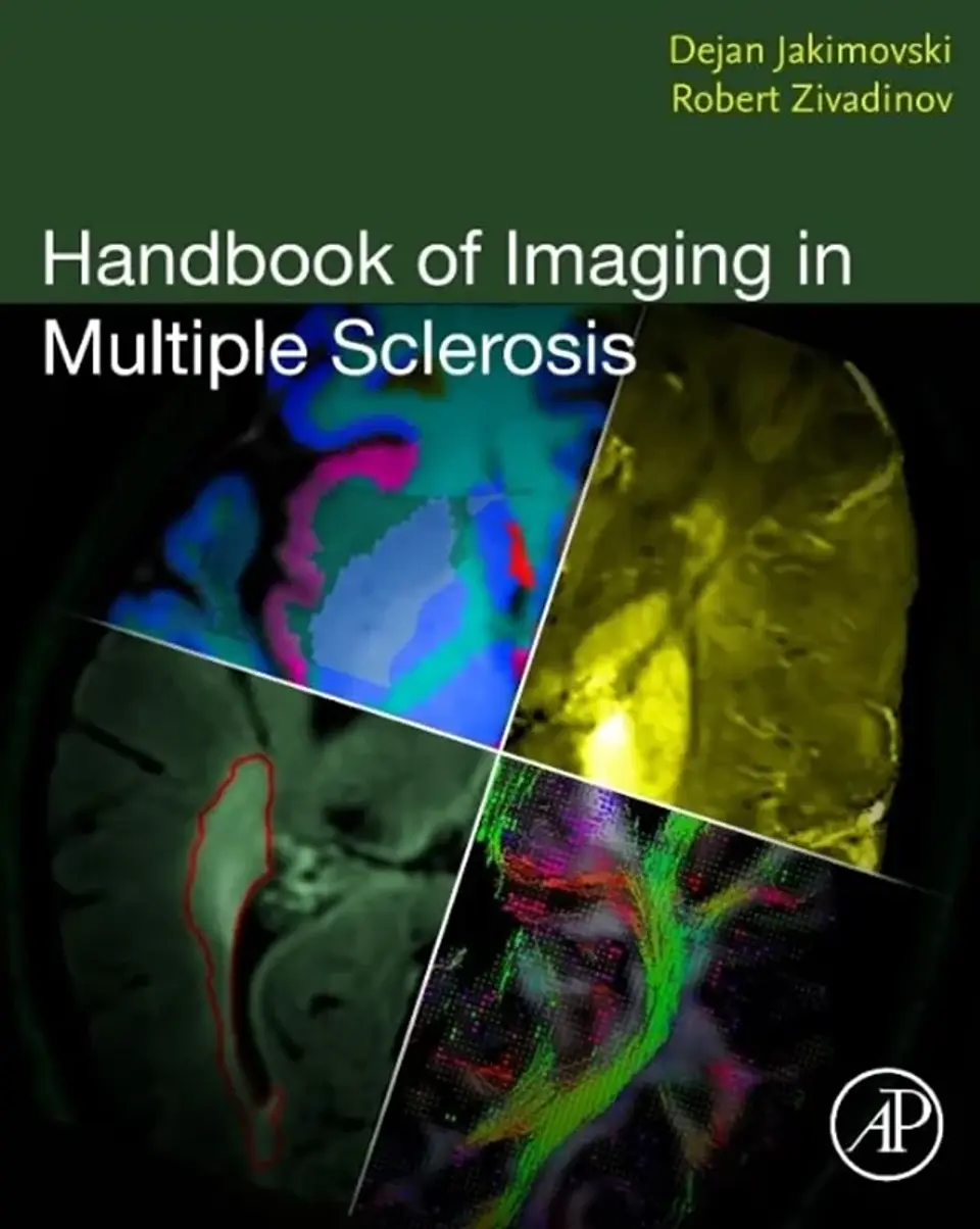 Handbook of Imaging in Multiple Sclerosis 1