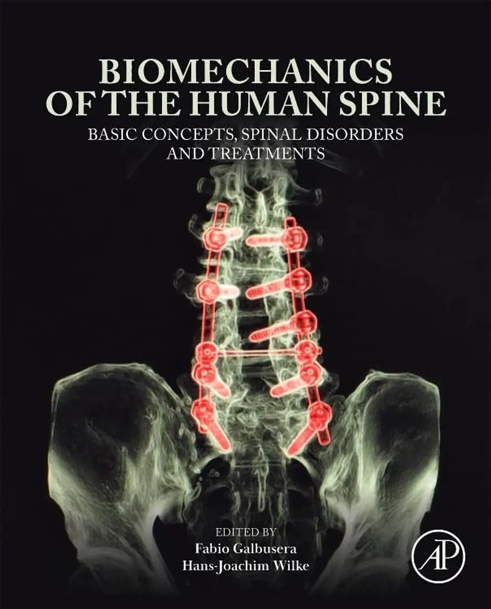 Biomechanics of the Human Spine: Basic Concepts, Spinal Disorders and Treatments 2nd Edition 1