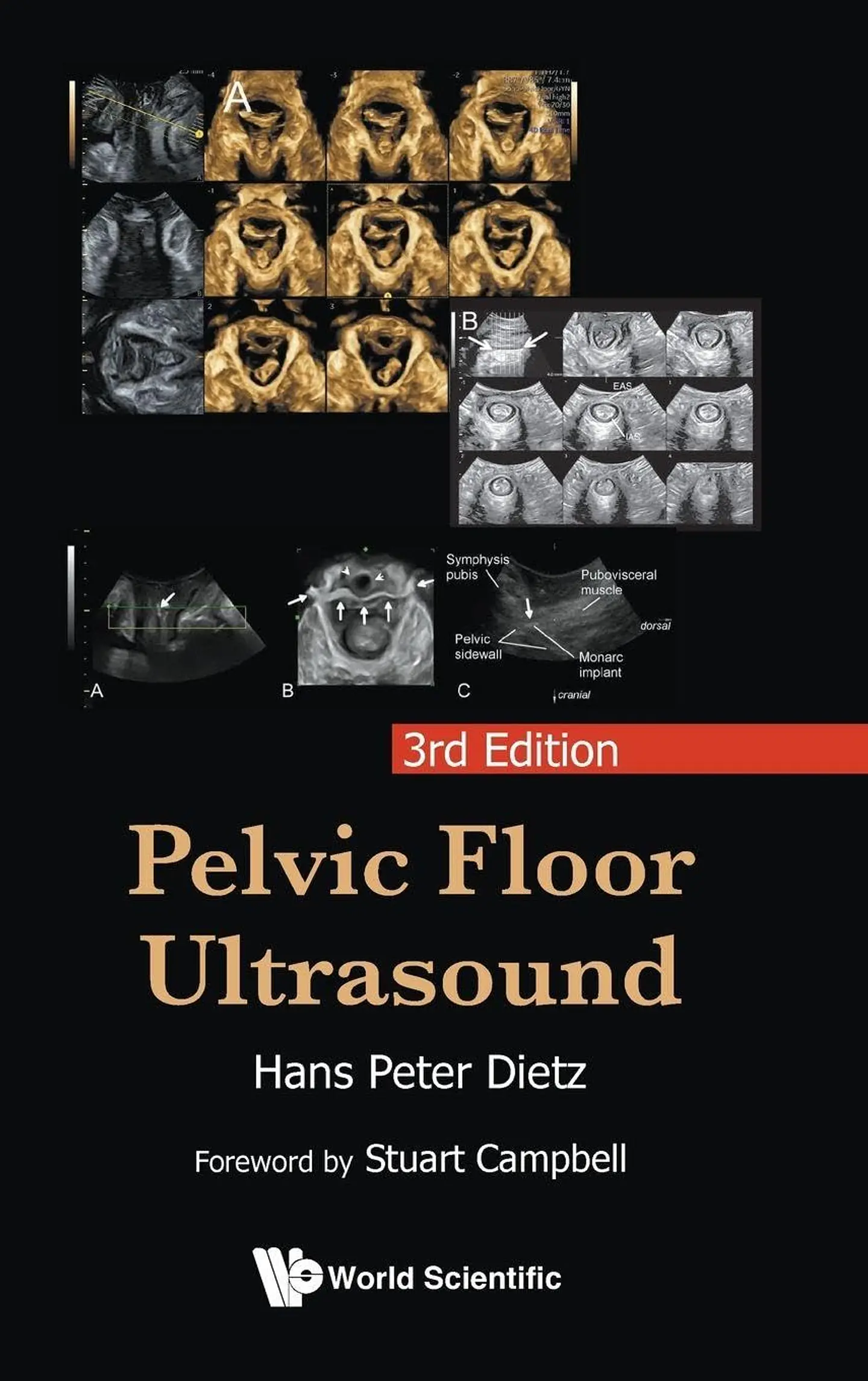 Pelvic Floor Ultrasound 3rd Edition 1