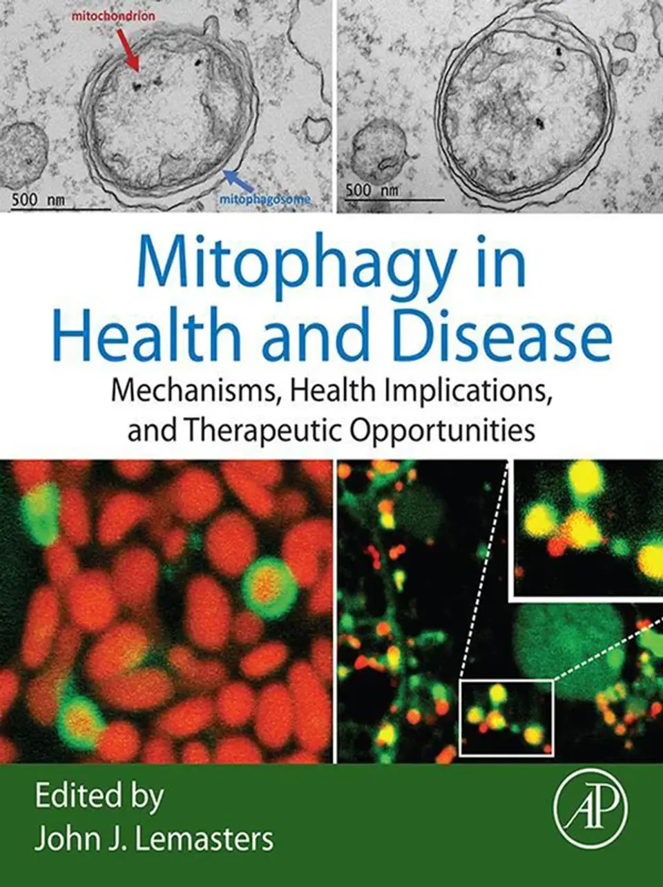 Mitophagy in Health and Disease: Mechanisms, Health Implications, and Therapeutic Opportunities 1