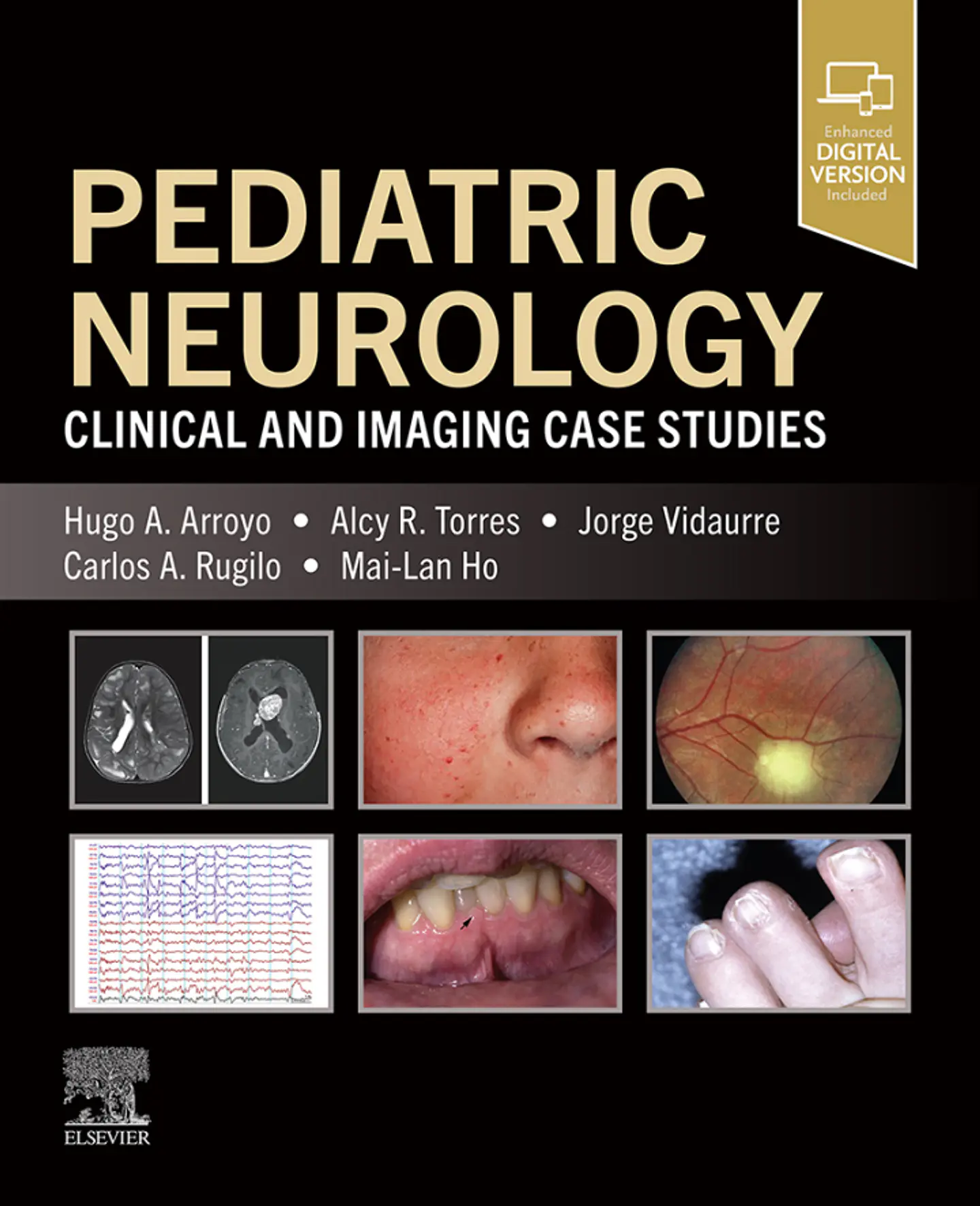 Pediatric Neurology: Clinical and Imaging Case Studies 1