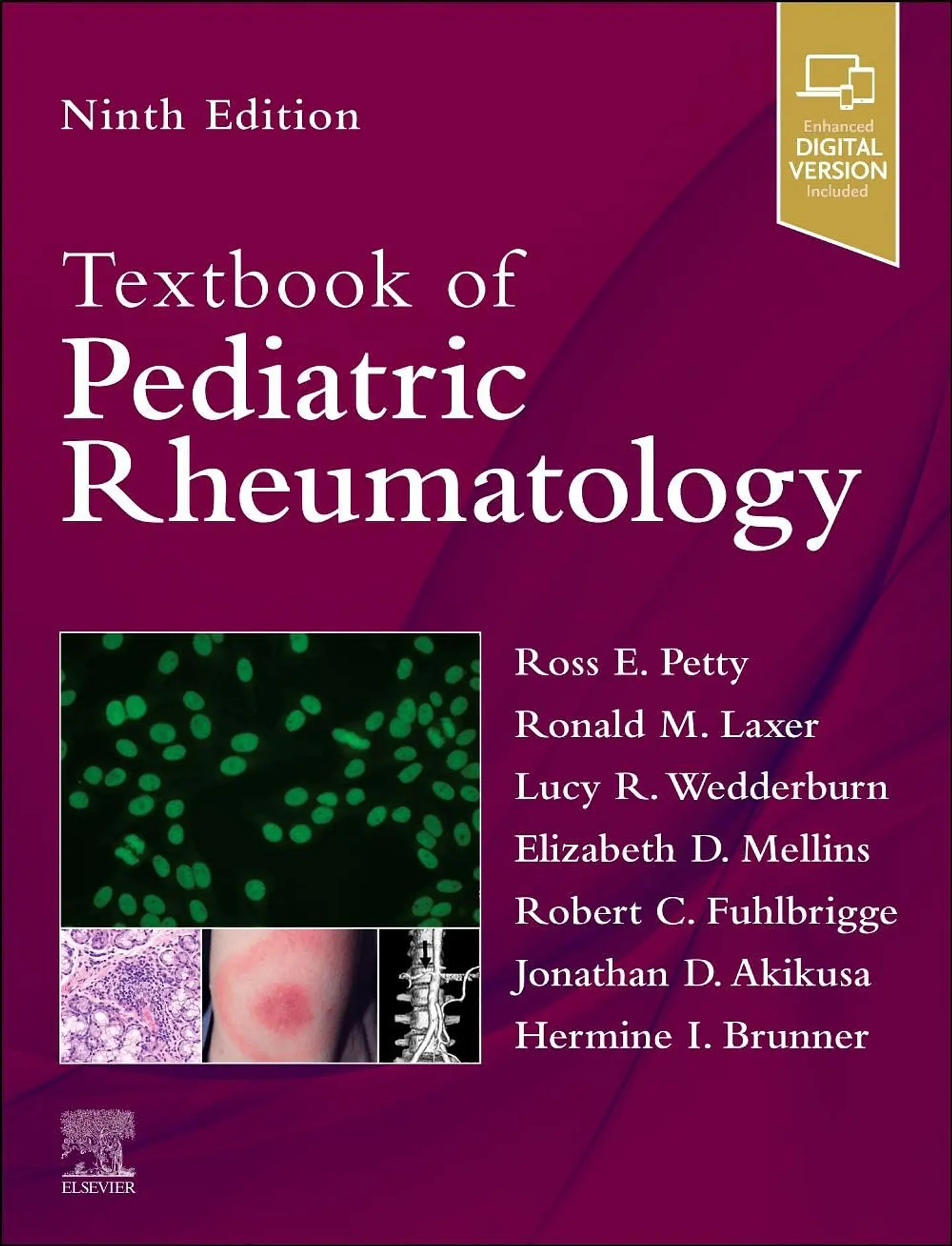 Textbook of Pediatric Rheumatology 9th Edition 1