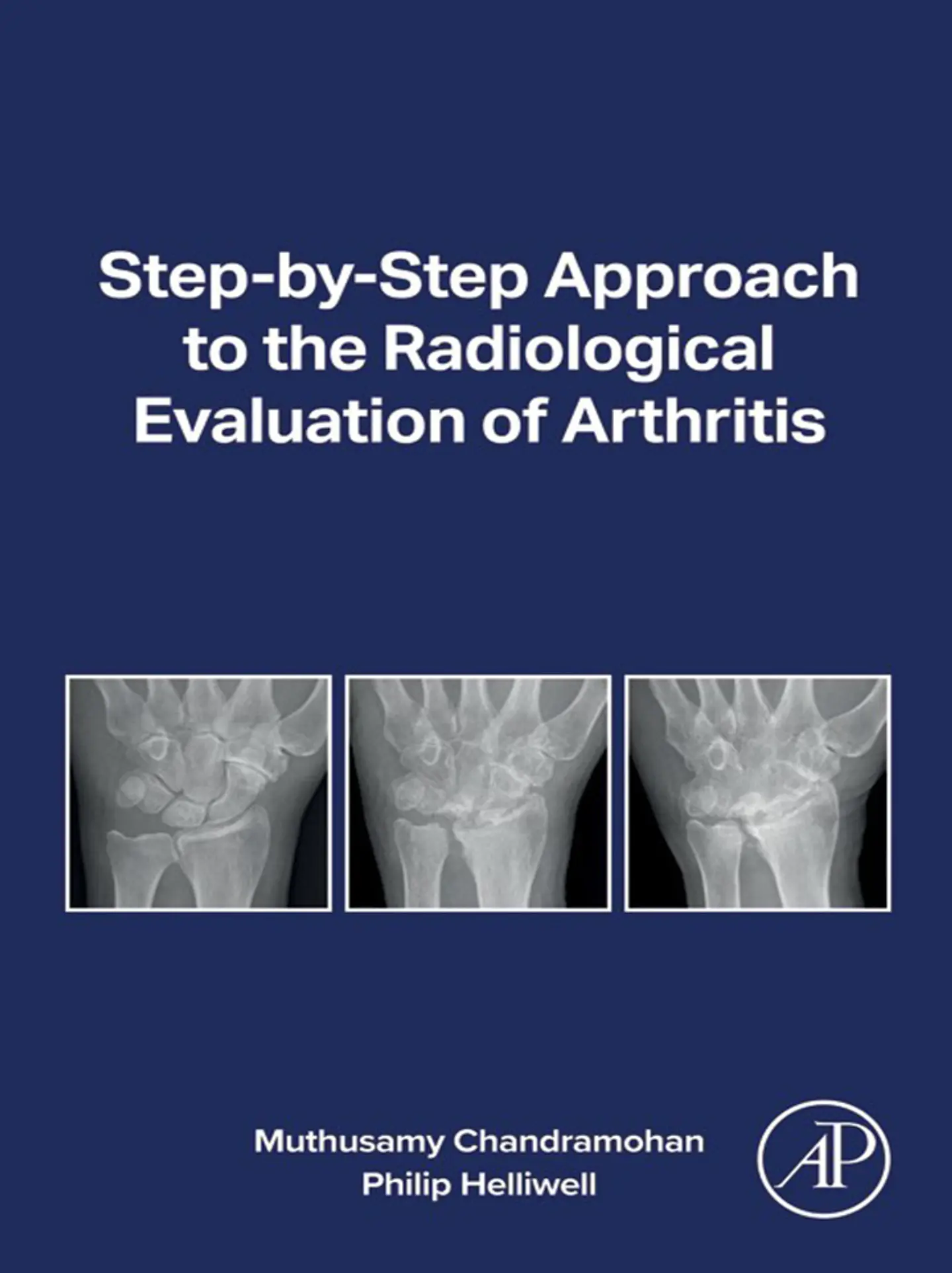 Step-by-step Approach to the Radiological Evaluation of Arthritis 1